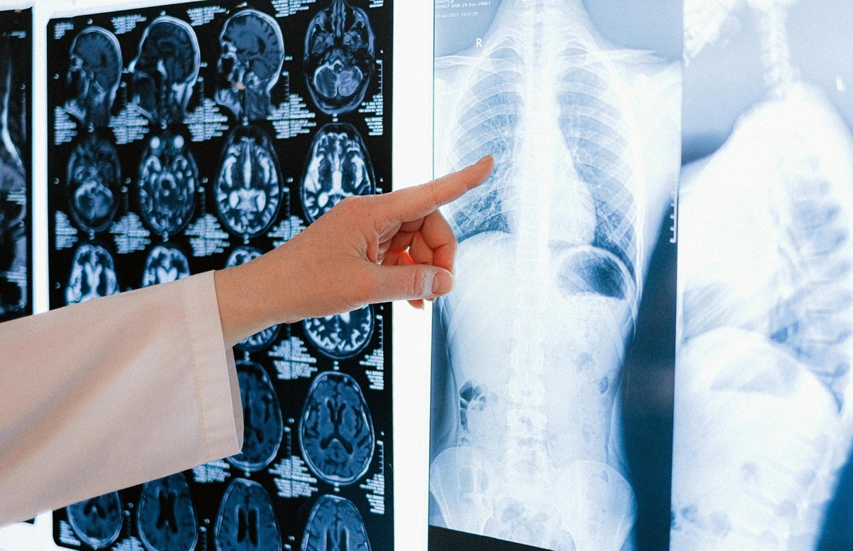 Clinician examining MRI brain scans and chest X-ray images on a lightbox